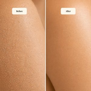 Nourishing Body Butter for Sensitive Skin - Image 4
