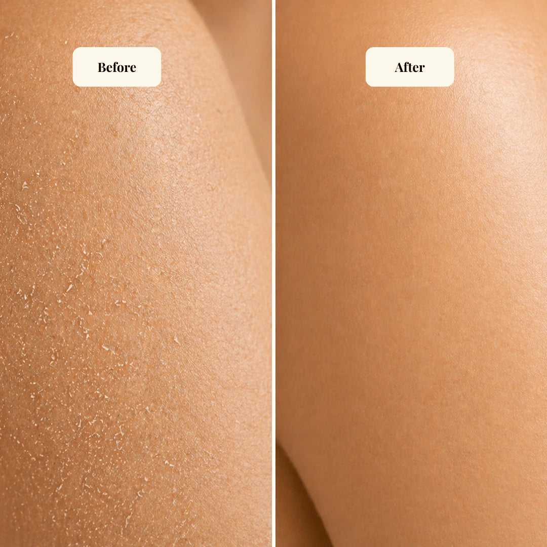 Nourishing Body Butter for Sensitive Skin - Image 4