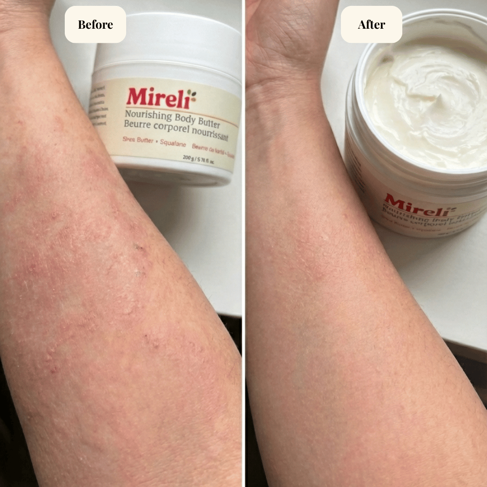 Nourishing Body Butter for Sensitive Skin - Image 2