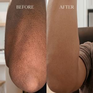 Nourishing Body Butter for Sensitive Skin - Image 3